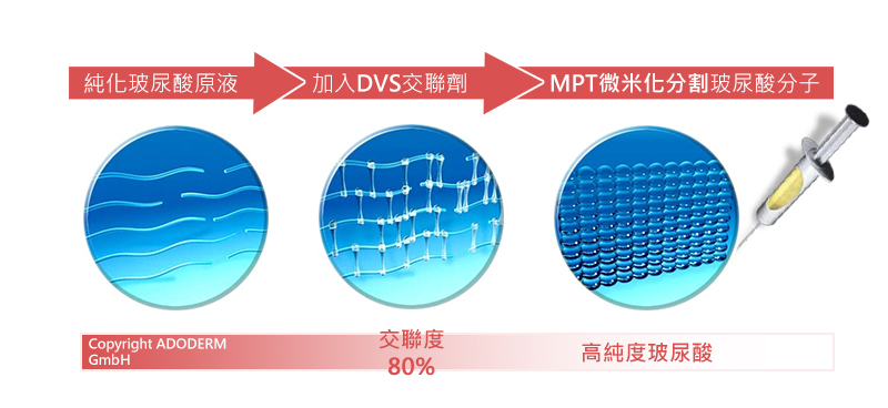  瘦身、瘦小臉、咀嚼肌、國字臉、蘿蔔腿、除皺、魚尾紋、眉間紋、抬頭紋、全臉拉提、肌肉放鬆、肉毒桿菌、小臉、醫美、巴掌臉、BOTOX、天使肉毒